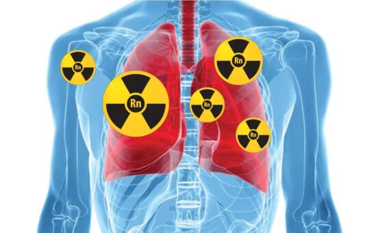 Що таке радон і як він може вплинути на ваше здоров’я?